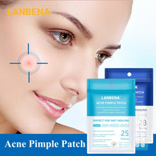 Load image into Gallery viewer, LANBENA Acne Pimple Patch Face Mask 28pcs Invisible Acne Stickers Blemish Treatment Pimple Remover Tool Skin Care Face Cream
